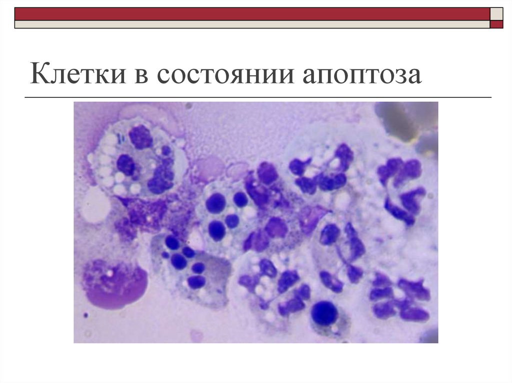 Состояние клетки. Апоптоз клетки. Пироптотические клетки. Клетка в апоптозе. Апоптоз клетки под микроскопом.