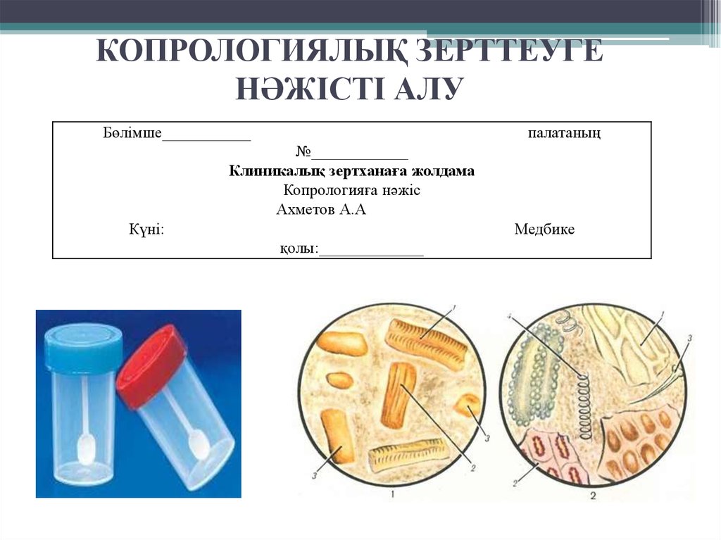 Жалпы зәр анализі презентация