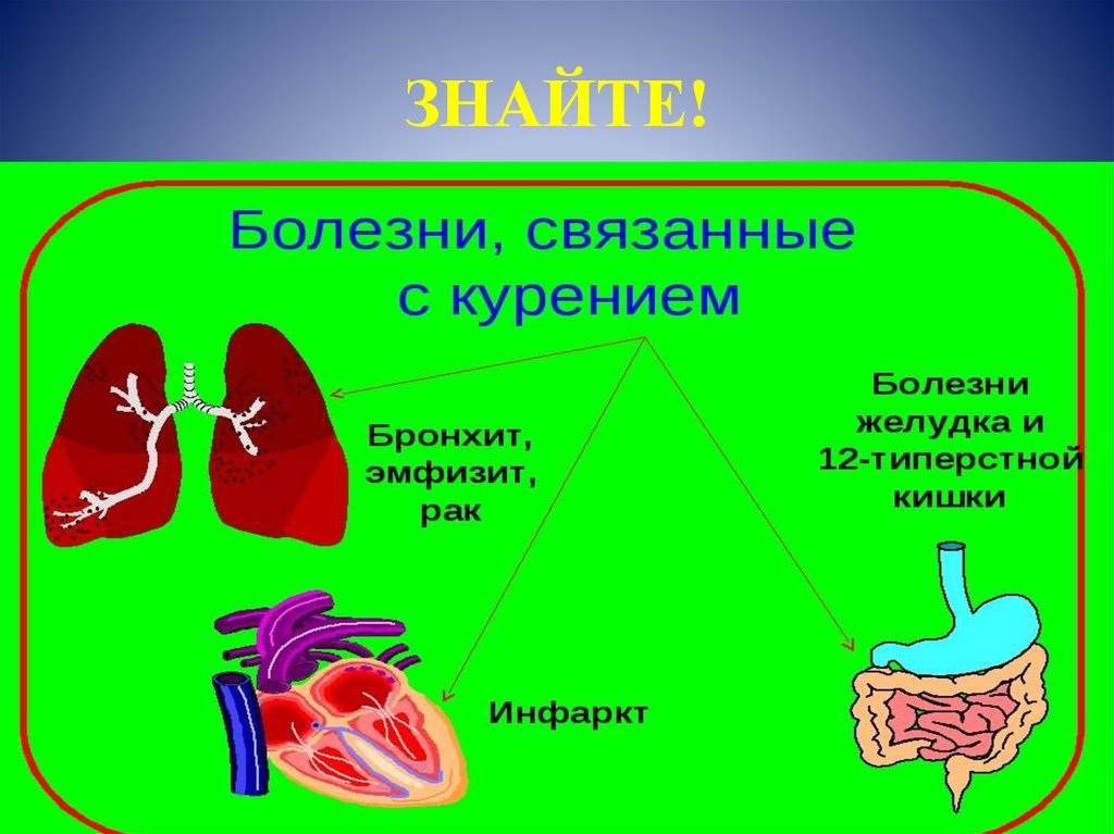 Болезни вызванные курением презентация