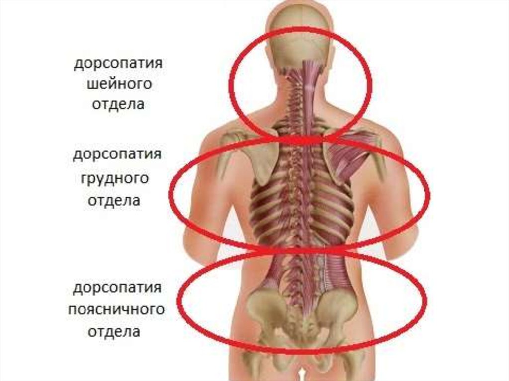 Код дорсопатия шейного отдела