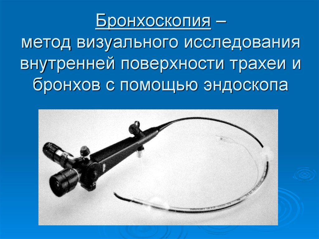 Бронхоскопия это. Бронхоскопия метод исследования. Методы исследования трахеи и бронхов.