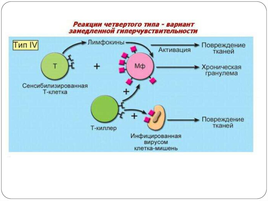 Схема гиперчувствительности 2 типа