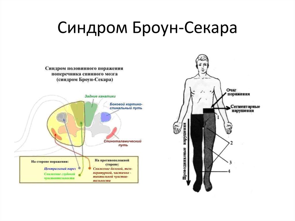 Неврология в картинках и схемах