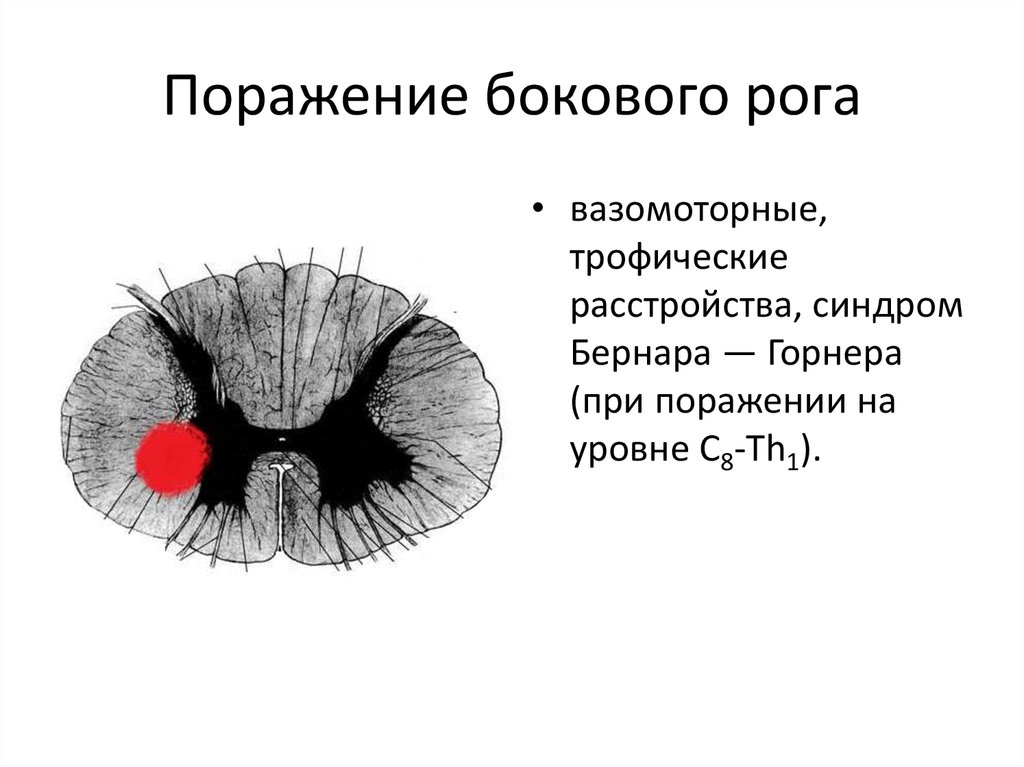 Задние боковые рога плоду