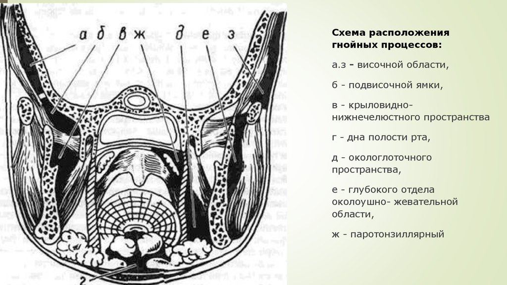 Пространства полости рта. Абсцесс окологлоточного пространства. Крыловидно челюстное пространство схема. Окологлоточное пространство пространство флегмона. Крыловидно нижнечелюстное пространство топографическая анатомия.
