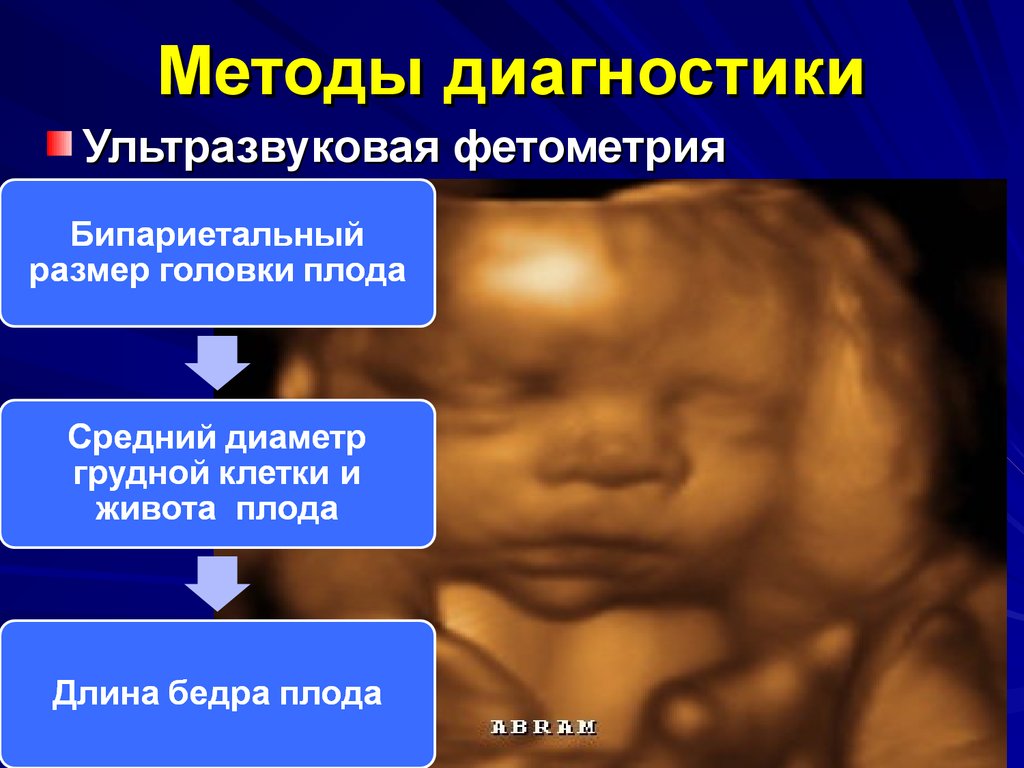 Фетометрия. Ультразвуковая фетометрия. Бипариетальный размер головки плода. Диаметр грудной клетки плода. Бипариетальный диаметр.