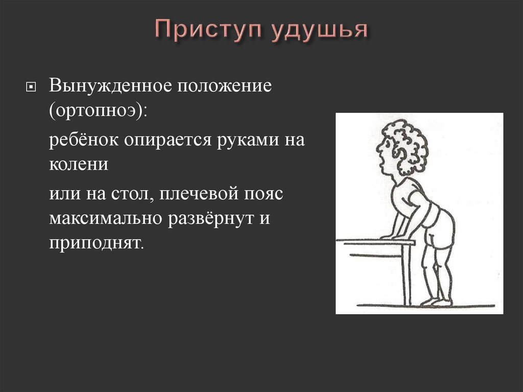 Опираясь на положения. Вынужденное положение при бронхиальной астме. Положение пациента при приступе удушья. Положение ребенка при приступе бронхиальной астмы.