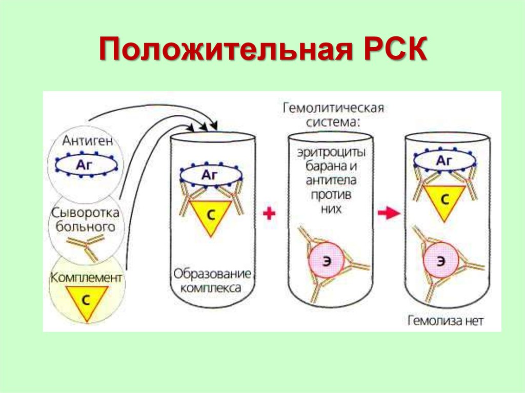 Схема постановки рск