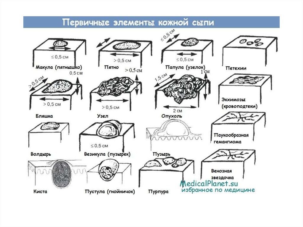 Первичные элементы. Первичные и вторичные элементы кожной сыпи. Первичные и вторичные морфологические элементы кожных высыпаний. Первичные морфологические элементы кожной сыпи. Вторичные элементы кожной сыпи.