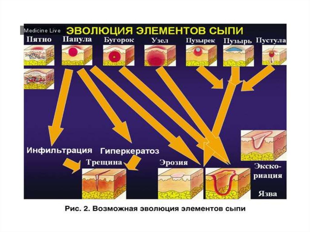 Вторичные элементы поражения. Вторичные морфологические элементы кожных высыпаний. Первичные морфологические элементы кожных высыпаний. Первичные морфологические элементы сыпи. Первичные и вторичные морфологические элементы кожных высыпаний.