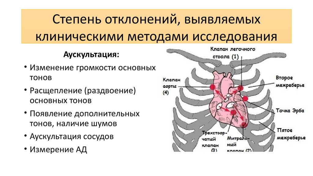 Пороки сердца аускультация