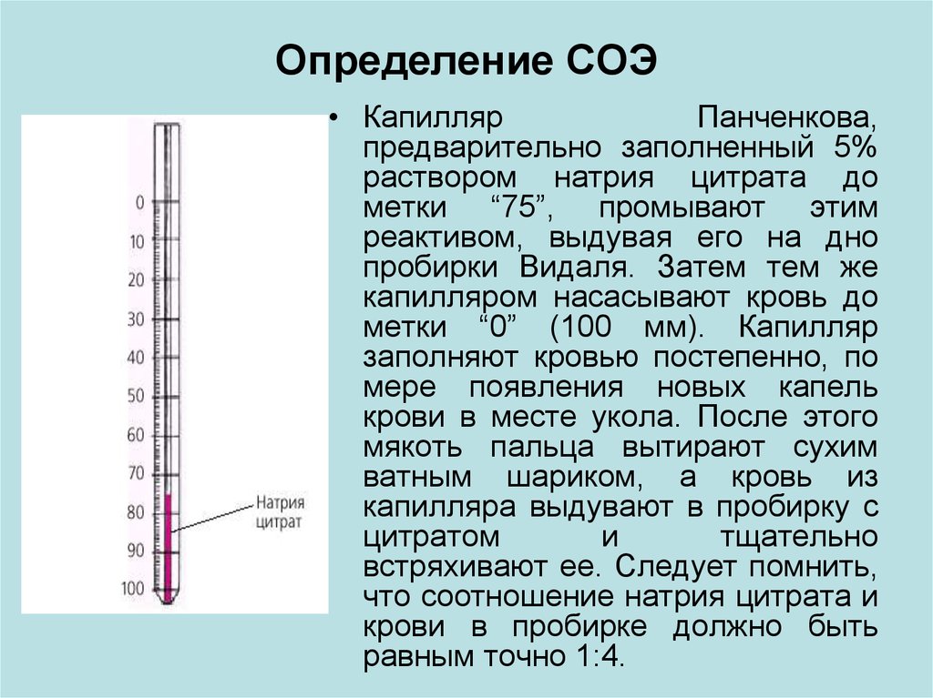 Что значат соэ по вестергрену