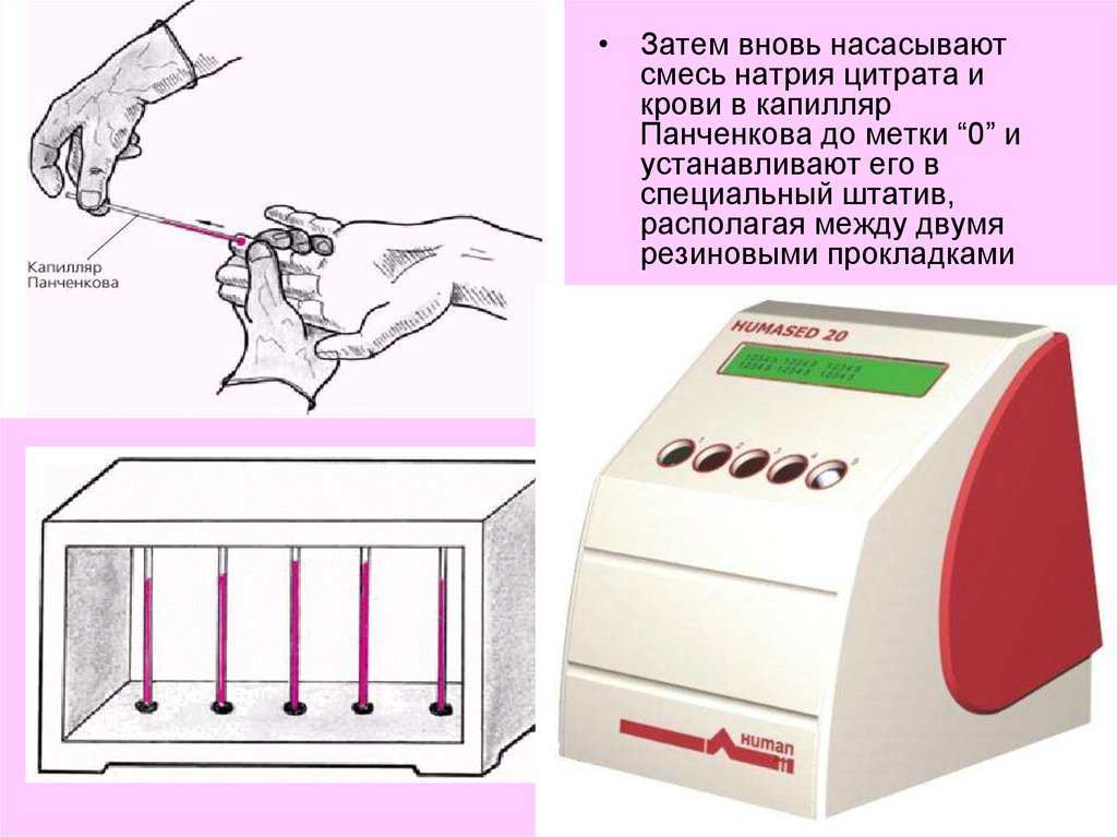 Затем снова. Капилляр к СОЭ-метру (капилляр Панченкова). Аппарат Панченкова для определения СОЭ крови. Капилляр Панченкова капилляр Панченкова. Капилляры к СОЭ метру.