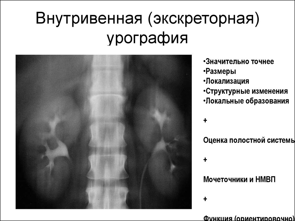 Внутривенная урография презентация