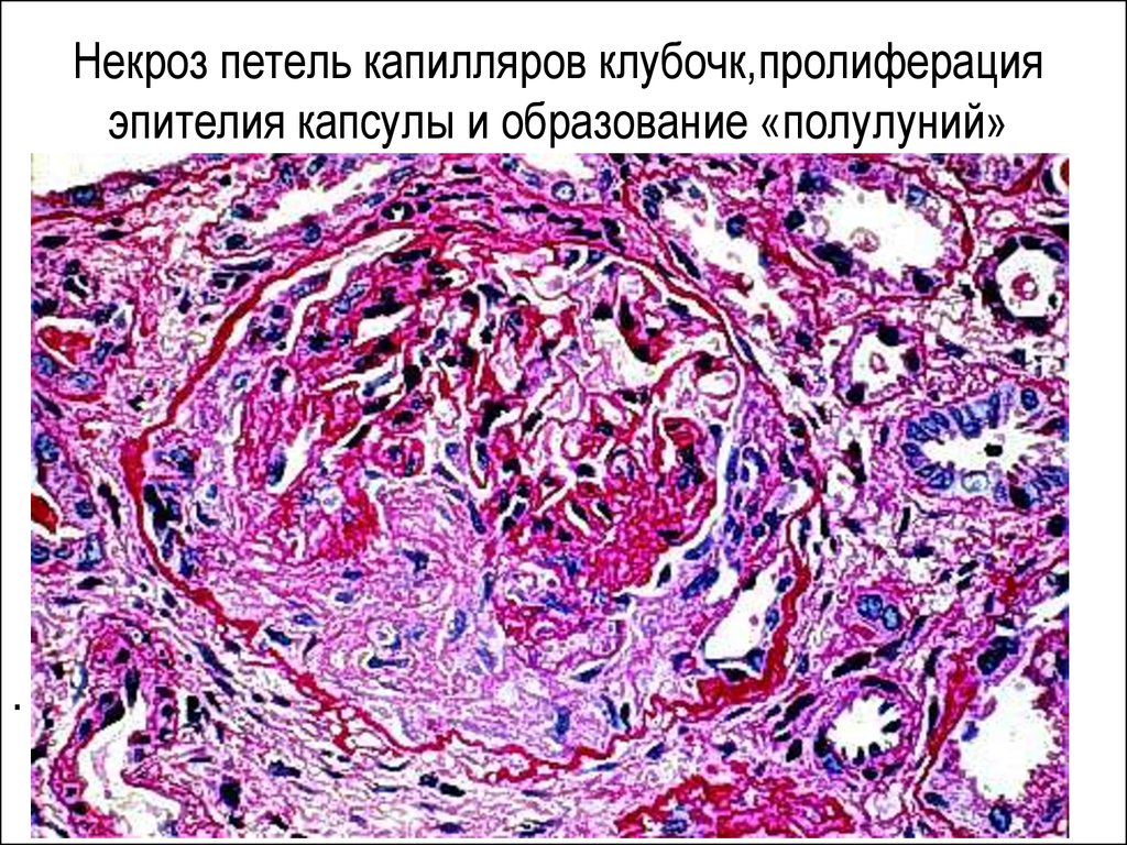 Пролиферация это. Пролиферация это в гистологии. Клеточная пролиферация гистология. Пролиферация капилляров. Пролиферация эпителия.