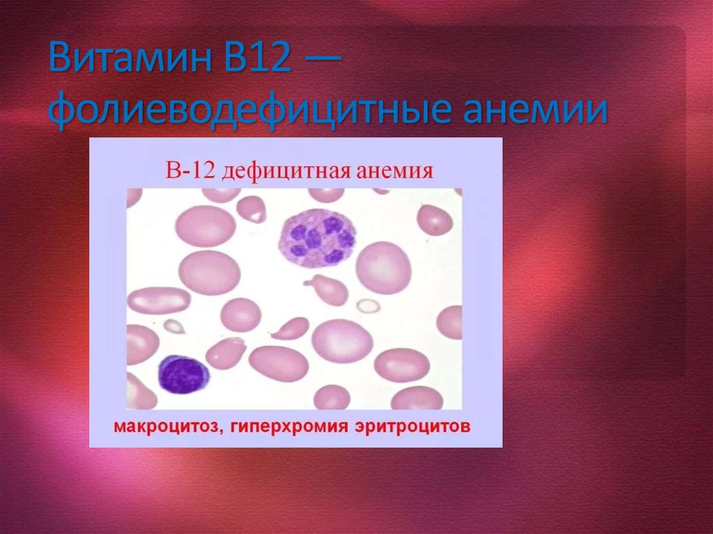 Картина крови при в12 и фолиеводефицитной анемии