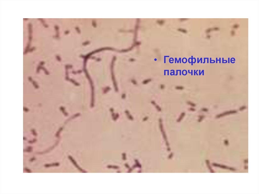 Haemophilus influenzae 10. Гемофильная палочка микроскопия. Haemophilus influenzae (гемофильная палочка). Гемофильная палочка под микроскопом. Haemophilus influenzae морфология.