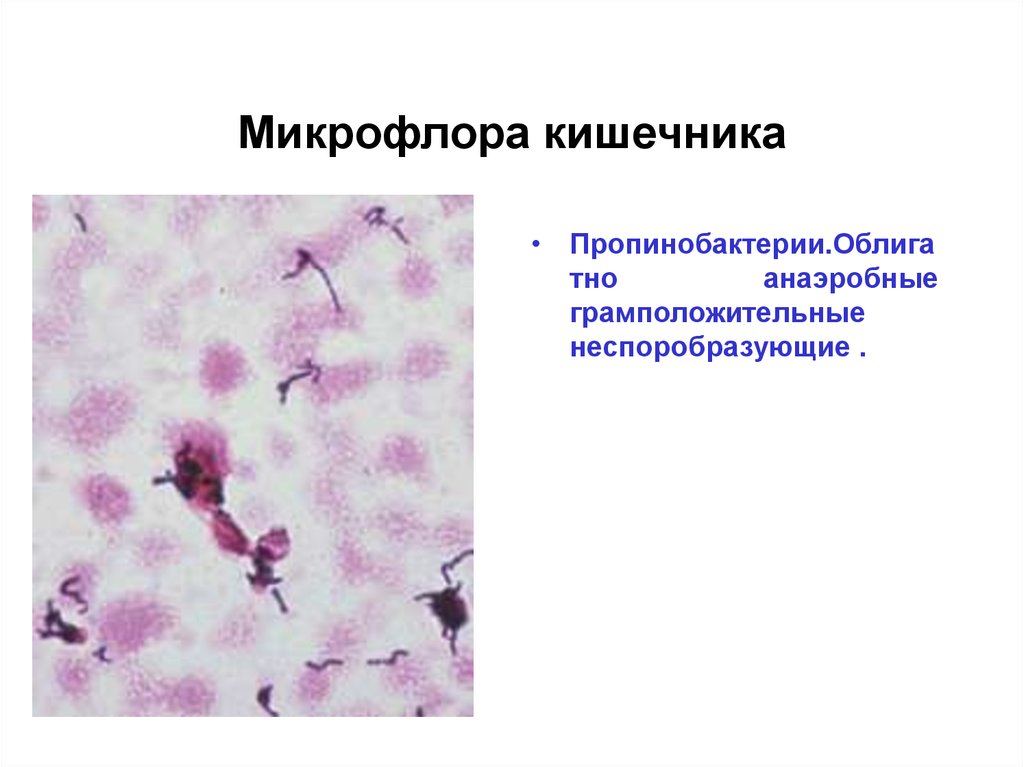 Микрофлора организма человека презентация - 95 фото