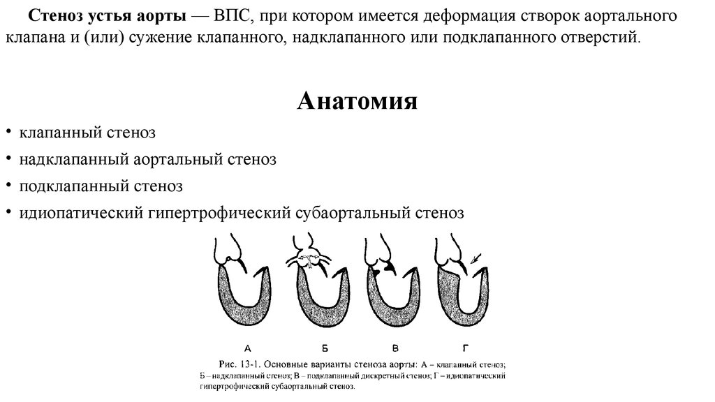 Аортальный стеноз что это такое