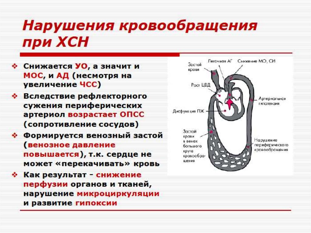 Недостаточность кровообращения презентация