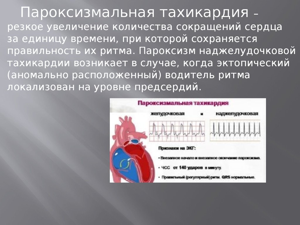 Пароксизмальная тахикардия карта вызова скорой медицинской