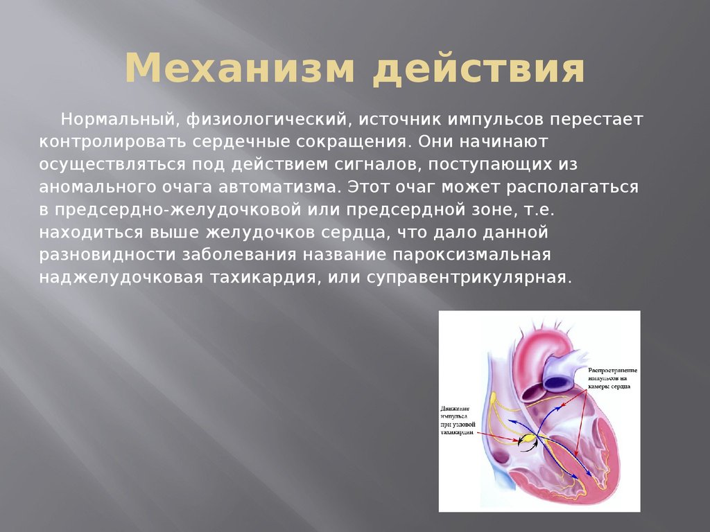 Суправентрикулярная тахикардия карта вызова скорой помощи