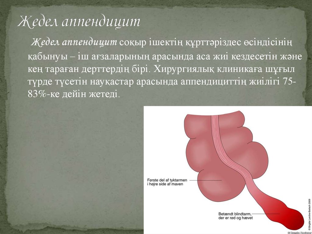 Схема лечения проктосигмоидита