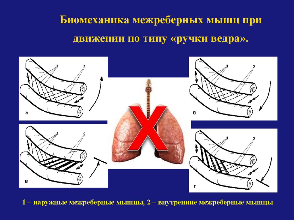 Уменьшение внутренних