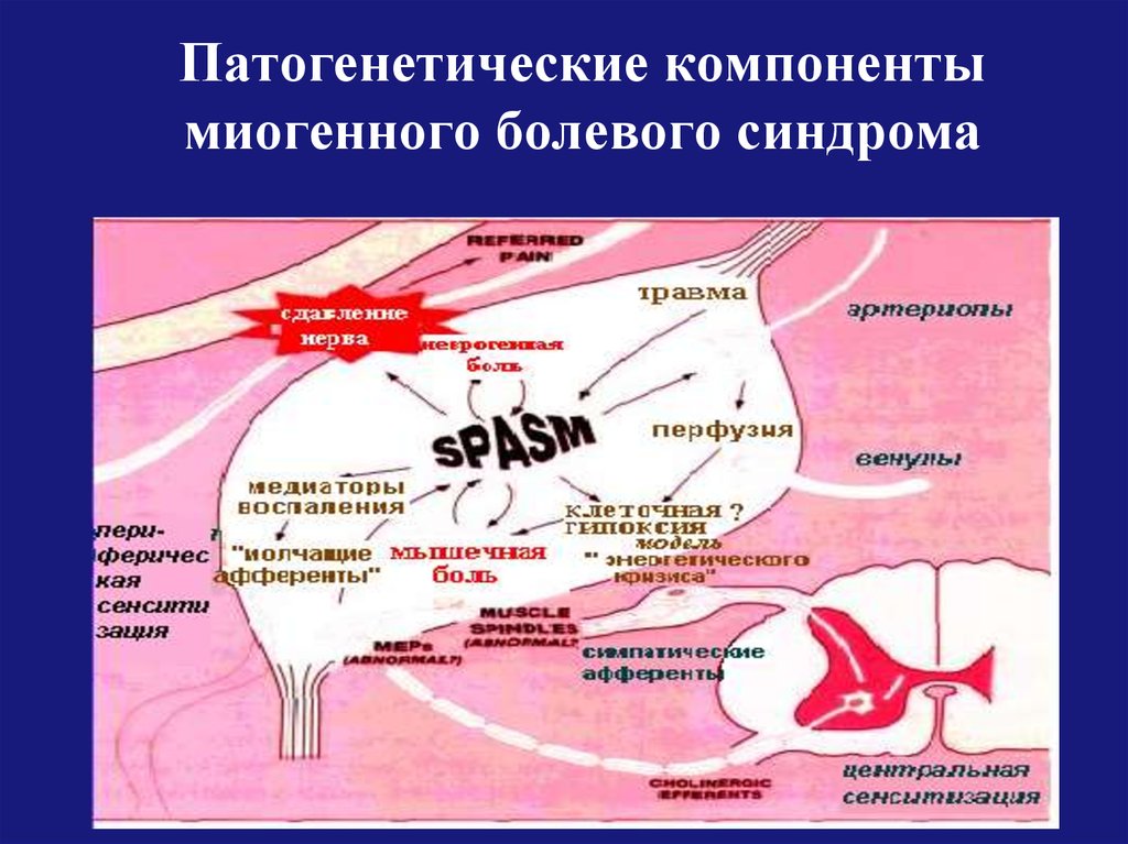 Патогенетические компоненты миогенного болевого синдрома