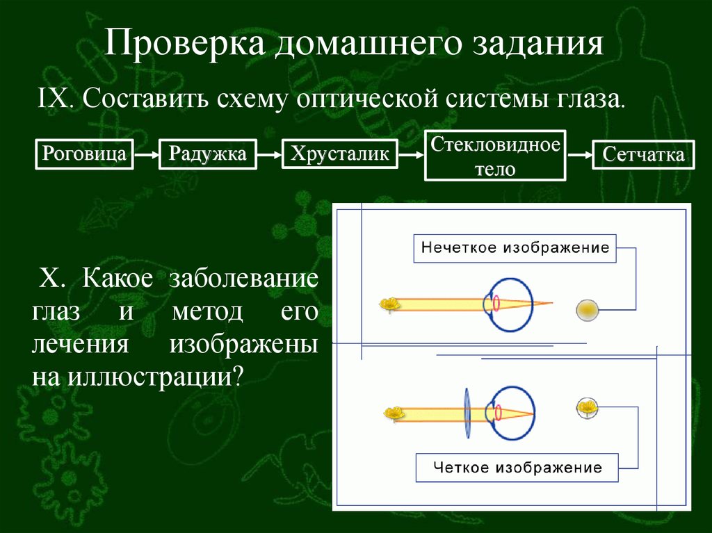 Неравенство величин изображения одного и того же предмета на сетчатке называется