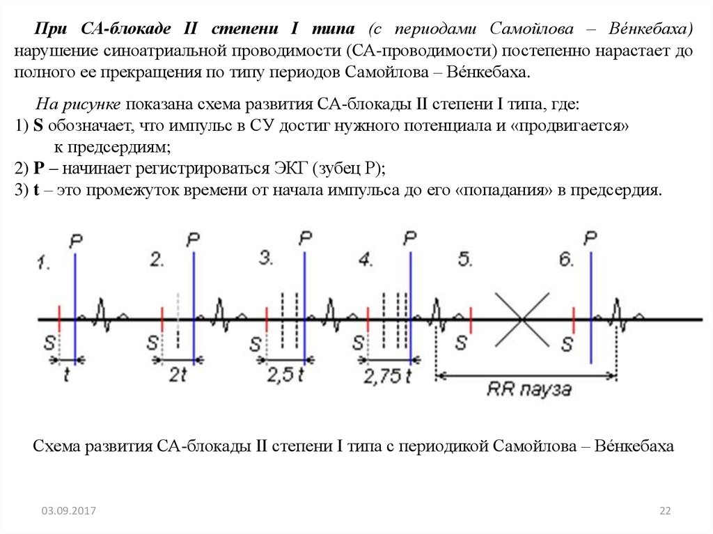 Замедление проводимости. Периоды Самойлова Венкебаха. Нарушение синоатриальной проводимости. Где нарушается проводимость при синоатриальной блокаде укажите.