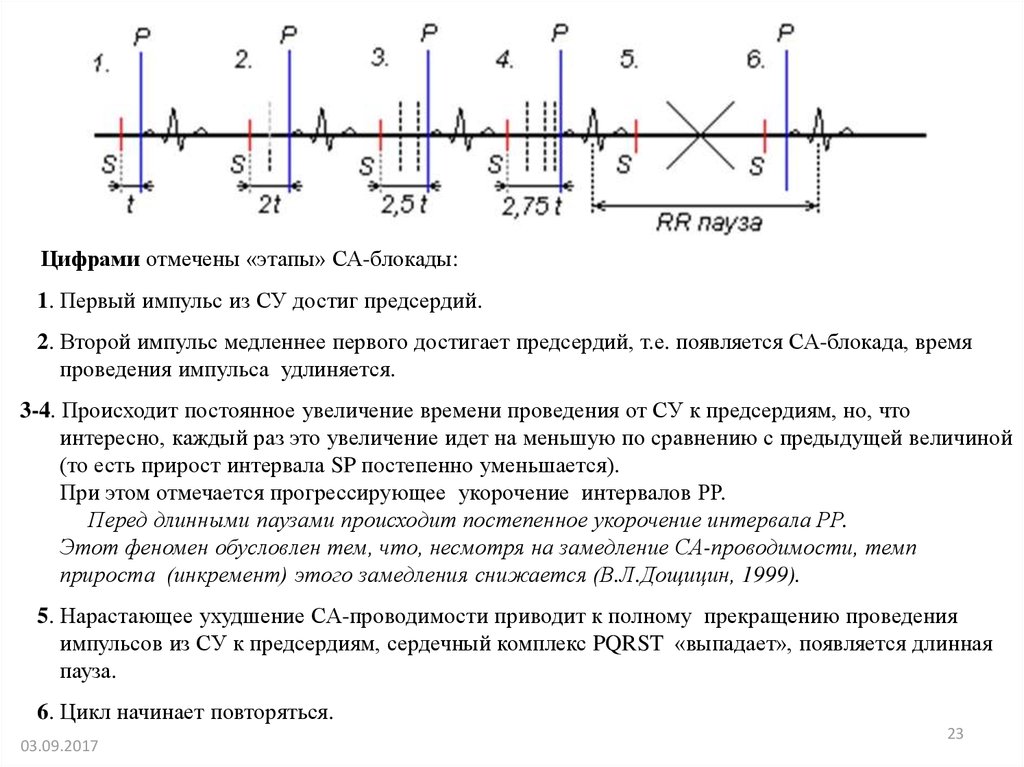 Замедление проводимости. Фазы проведения импульса. Замедление проведения импульса по av узлу. Непрерывные типы проведения импульсов.