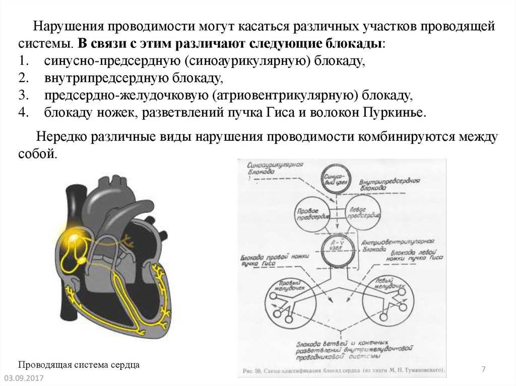 Проводимость сердца. Блокада проводящей системы сердца. Принципы фармакотерапии блокад проводящей системы сердца. Различают атриовентрикулярную блокаду. Проводящая система сердца внутрипредсердная блокада.