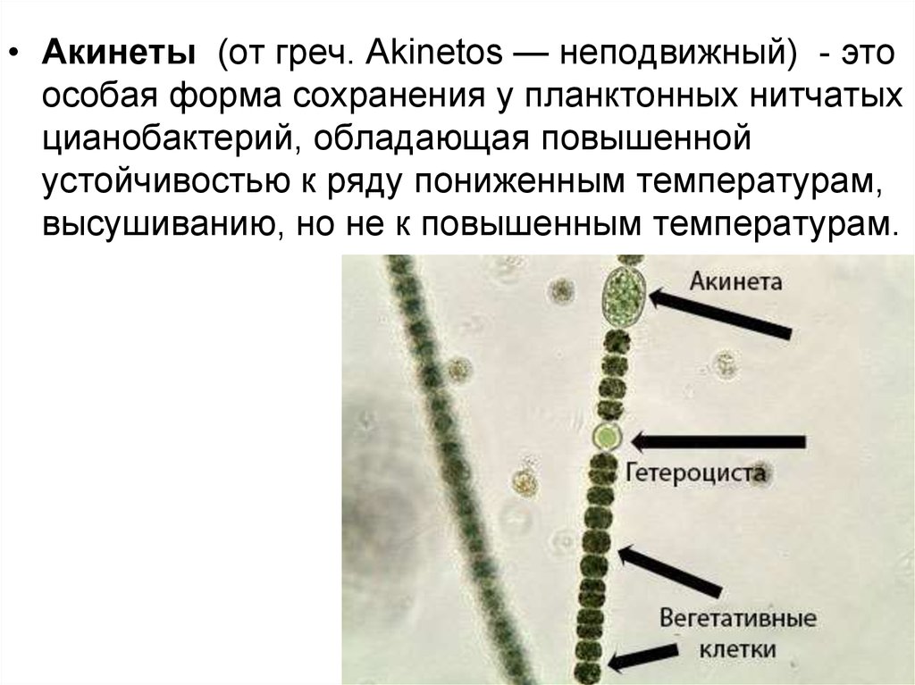 Клетки водорослей и цианобактерий. Цианобактерии размножение. Клетки цианобактерий. Вегетативная клетка цианобактерий. Гетероцисты и акинеты цианобактерий.