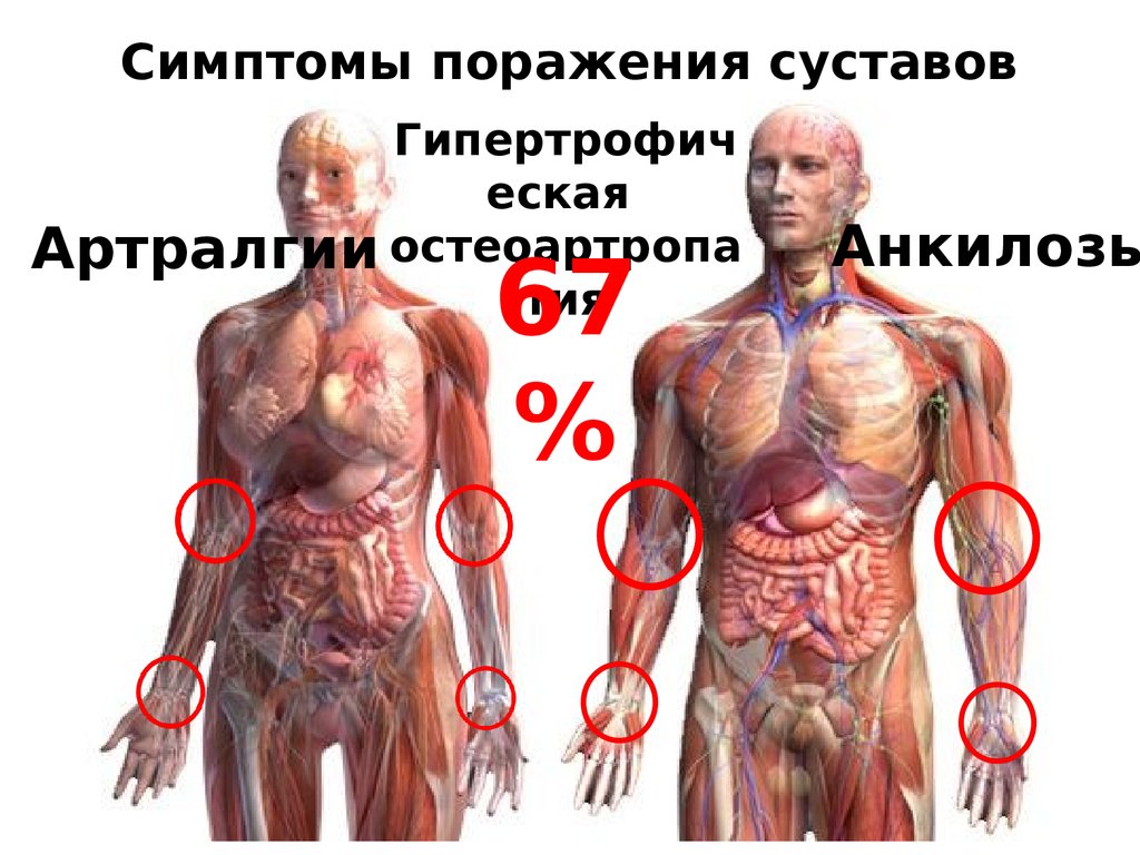 Симптомы поражения суставов
