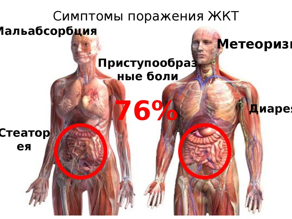 Симптомы поражения ЖКТ