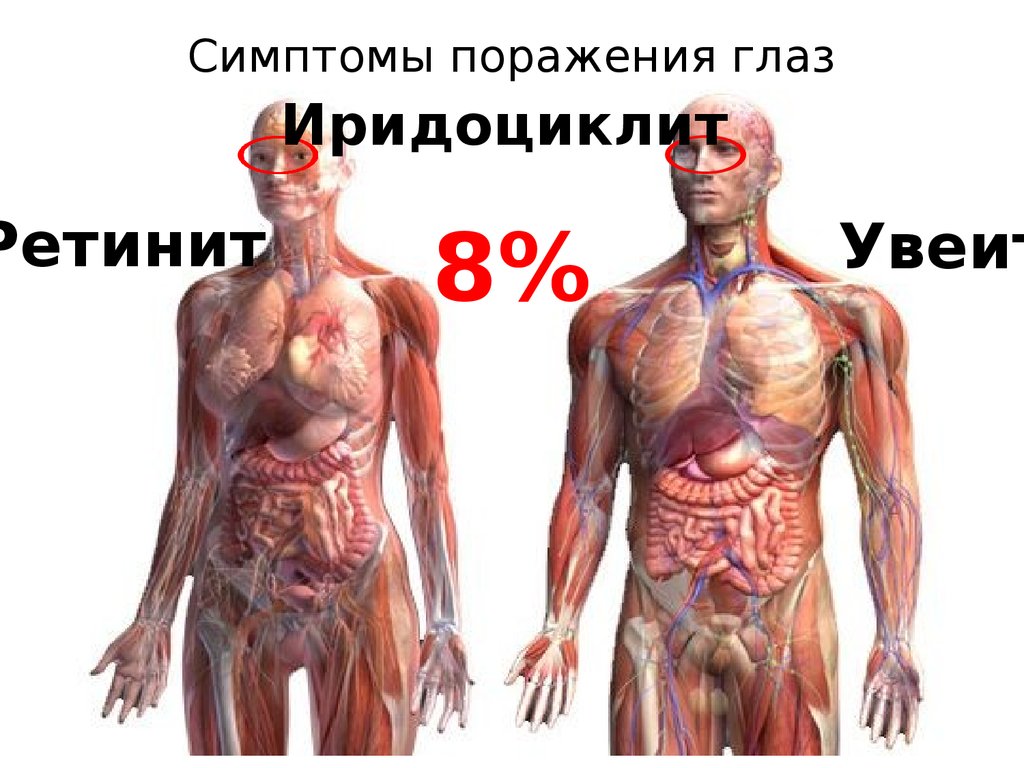 Симптомы поражения глаз