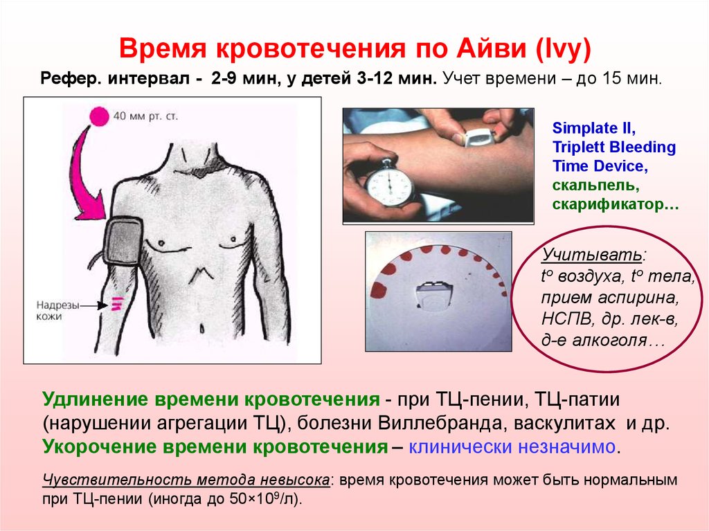 Время кровотечения. Длительность кровотечения по Дьюку норма. Метод определения времени кровотечения по Дьюку. Длительность кровотечения по Айви. Норма кровотечения по Дуке.