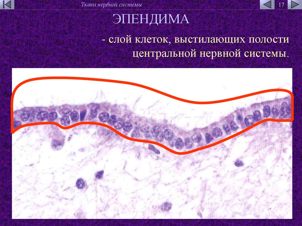 Полостям нервной системы. Эпендимоциты гистология. Эпендимные клетки глии. Эпендимная глия препарат гистология. Эпендимоциты гистология препарат.