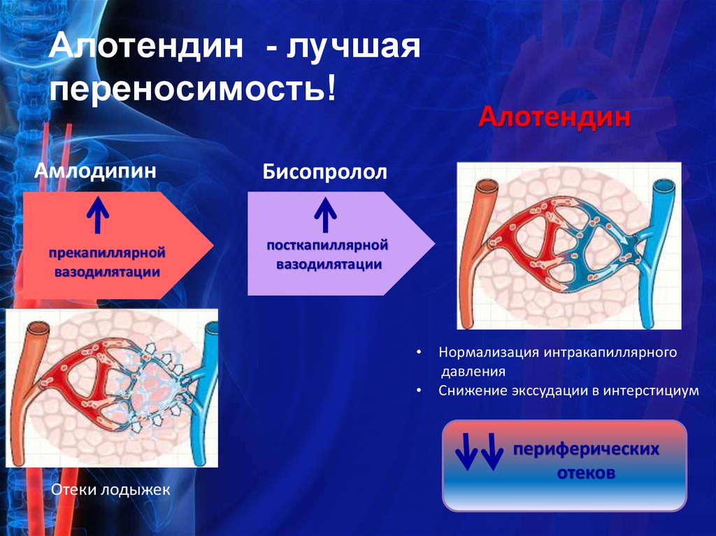 Амлодипин отеки. Амлодипин отеки механизм. Отечный синдром амлодипин. Амлодипин и периферические отеки.