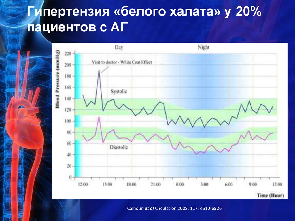 Синдром белого халата