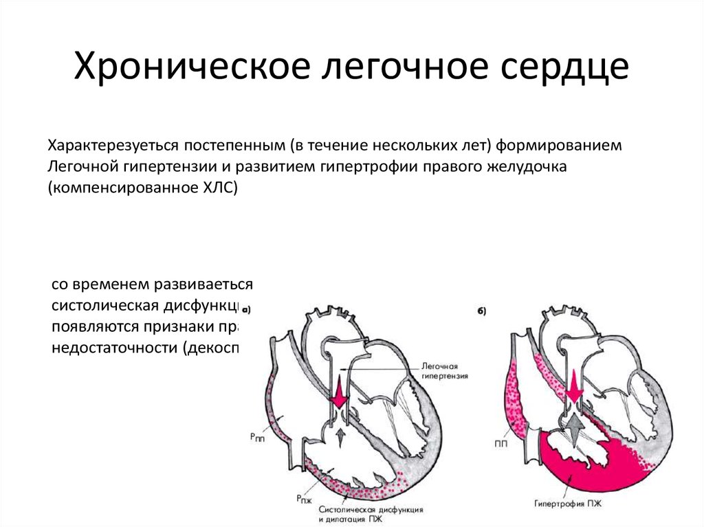 Легочное заболевание сердца. Механизмы формирования легочно-сердечной недостаточности.. Синдром хронического легочного сердца. Хроническое легочное сердце легочная гипертензия. Причины развития легочного сердца.