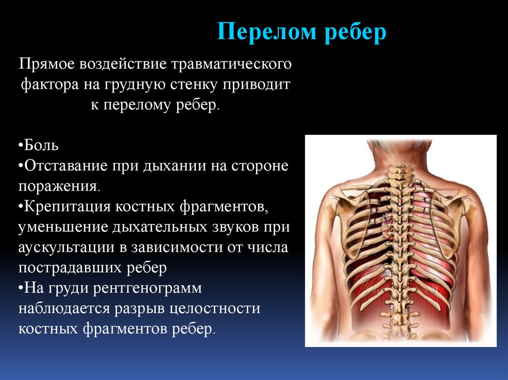 Презентация повреждения грудной клетки