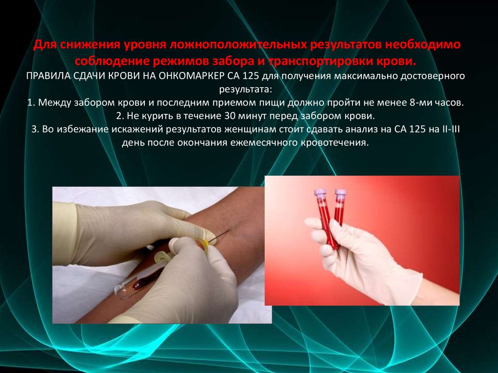 Для снижения уровня ложноположительных результатов необходимо соблюдение режимов забора и транспортировки крови. ПРАВИЛА СДАЧИ КРОВИ НА 