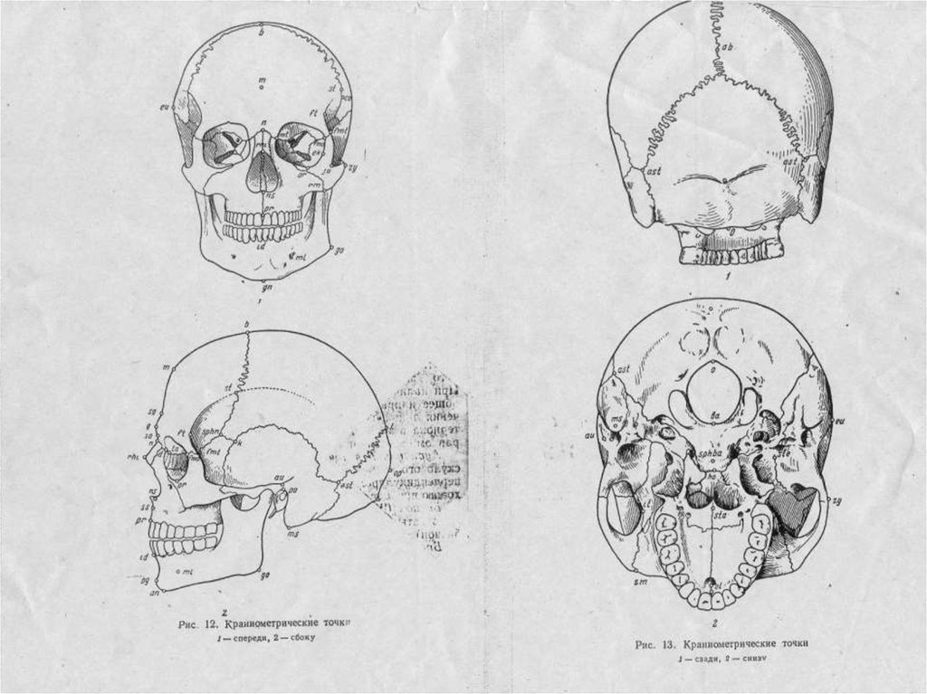 О чем говорят формы черепа. Краниометрические точки черепа сбоку. Череп спереди сбоку сзади. Аномальные формы черепа.