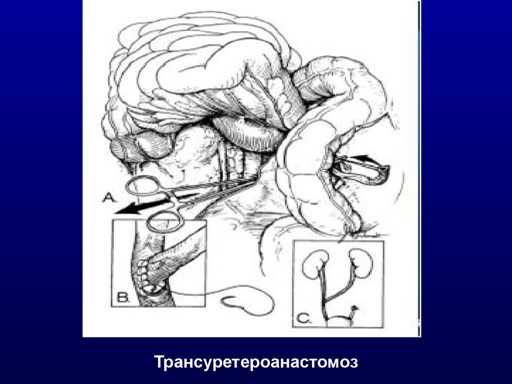 Травмы органов мочевыделительной системы презентация