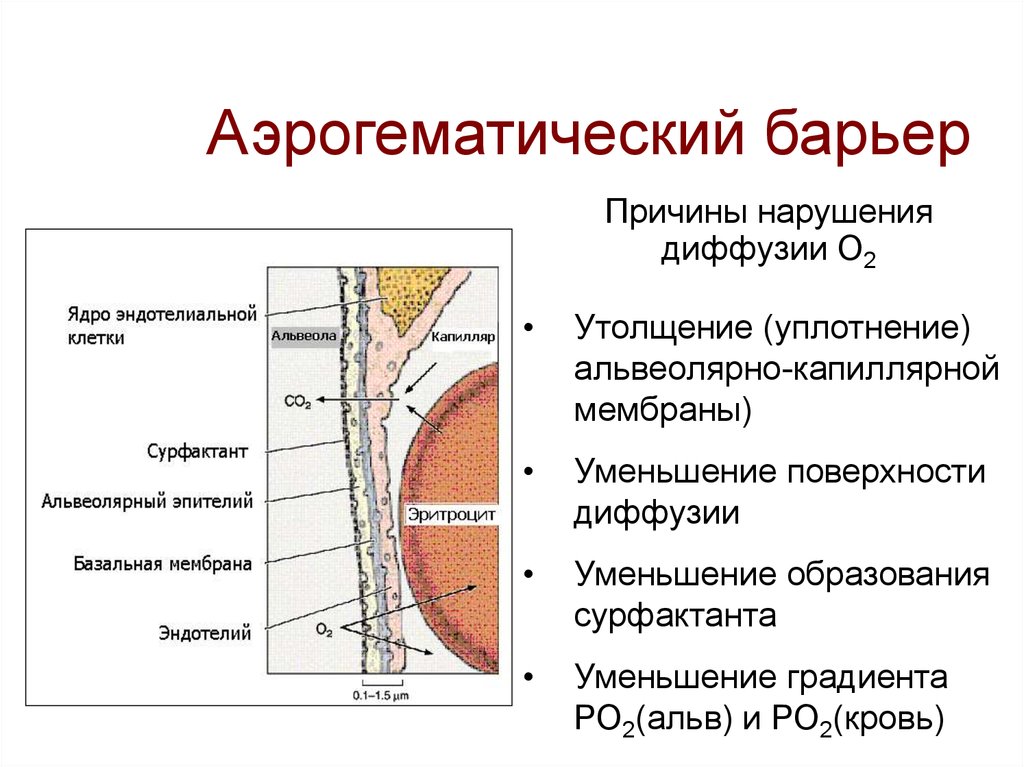 Аэрогематический барьер схема