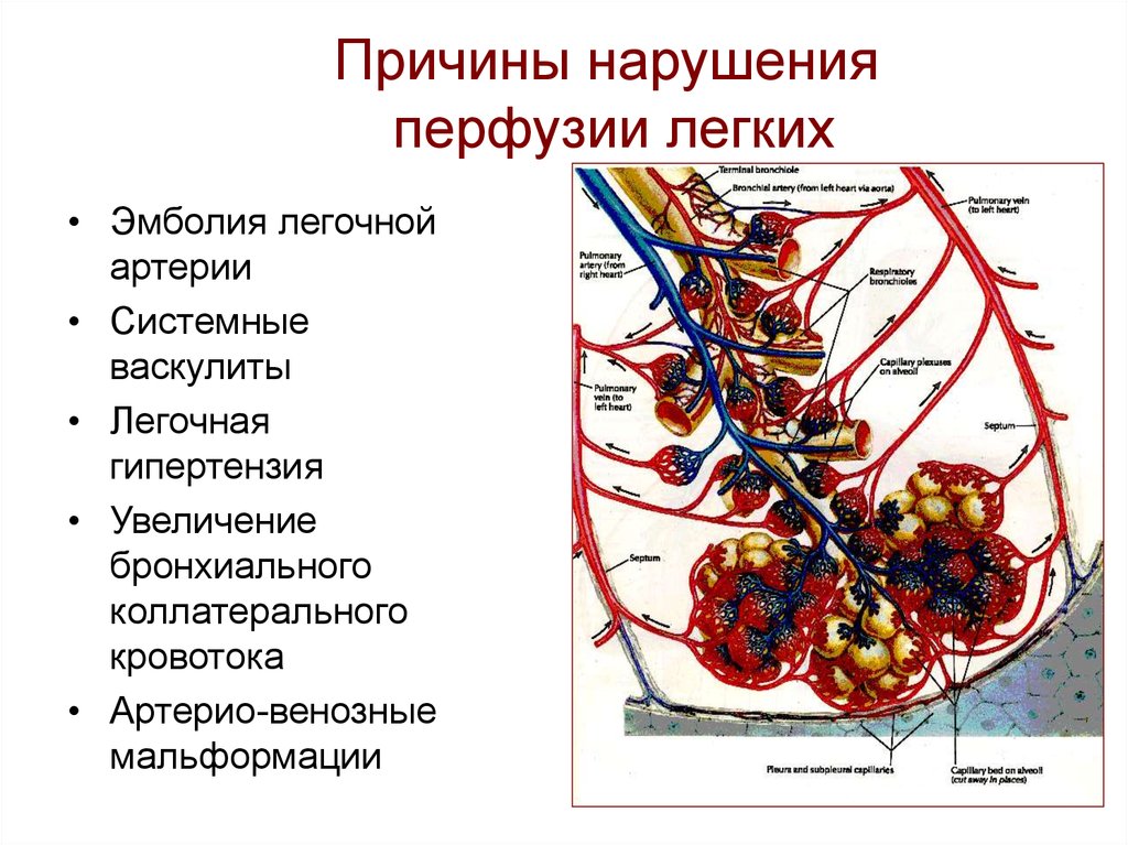 Почему нарушение. Причины нарушения перфузии легких. Нарушения перфузии легких. Этиопатогенез. Расстройства перфузии лёгких. Механизм развития нарушений легочной перфузии.