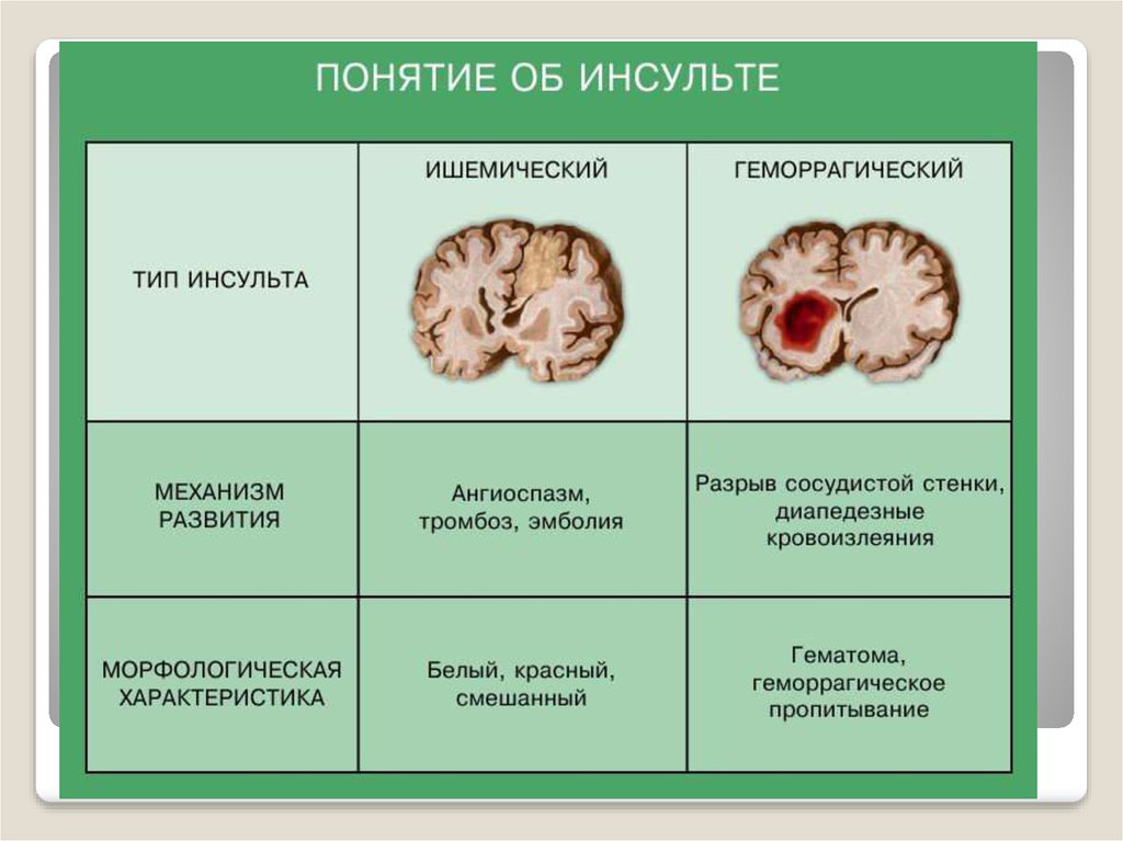 Инсульт различия. Механизм развития ишемического инсульта. Механизм развития ишемического инсульта таблица. Инсульт бывает ишемический и геморрагический. Ишемический и геморрагический инсульт головного мозга.