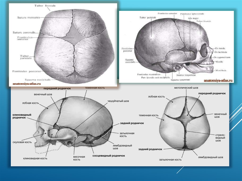 Стреловидный родничок. Швы и роднички черепа анатомия. Ламбдовидный шов черепа. Стреловидный венечный и затылочный швы. Швы и роднички головки.